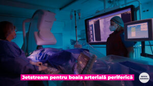 arteriopatia obliterantă.00_02_24_12.Still004