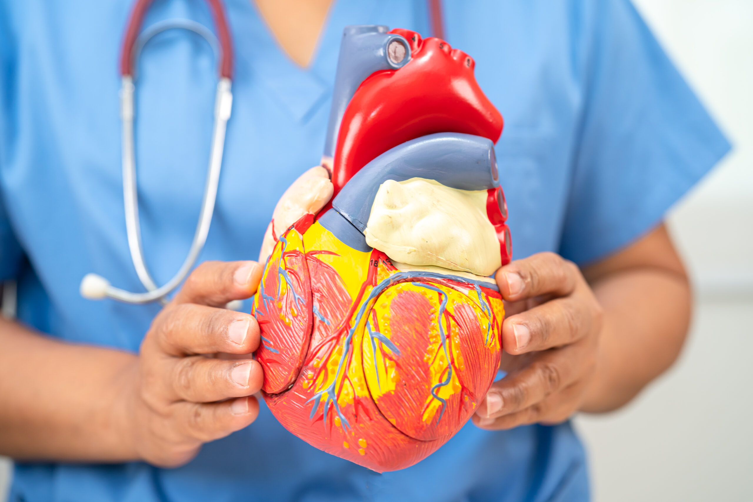 Cardiovascular disease CVD, Asian doctor holding human anatomy m