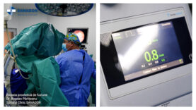 Biopsia prostatică de fuziune .00_00_16_22.Still002