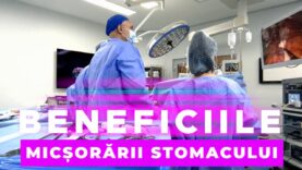 BENEFICIILE MICSORARII STOMACULUI