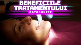 BENEFICIILE TRATAMENTULUI ORTODONTIC