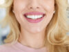 Blonde lady showing beautiful white teeth, cropped