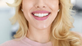 Blonde lady showing beautiful white teeth, cropped