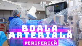 BOALA ARTERIALĂ PERIFERICĂ