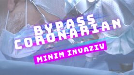 BYPASS CORONARIAN