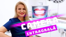 CAMERA INTRAORALĂ