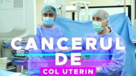 CANCERUL DE COL UTERIN