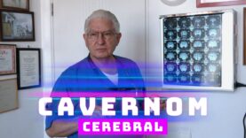 CAVERNOM CEREBRAL