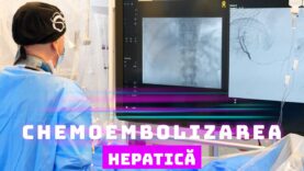 CHEMOEMBOLIZAREA HEPATICĂ