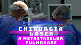 CHIRURGIA LASER A METASTAZELOR