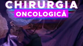 CHIRURGIA ONCOLOGICĂ