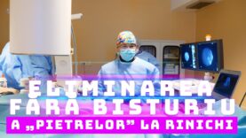 ELIMINAREA FĂRĂ BISTURIU A ,,PIETRELOR” LA RINICHI