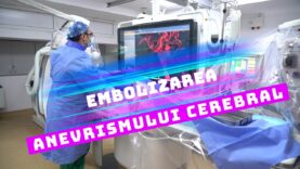 EMBOLIZAREA                         ANEVRISMULUI CEREBRAL