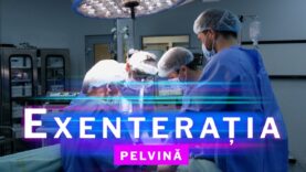 EXENTERAȚIA PELVINĂ