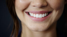 face-smile-and-teeth-with-woman-and-dental-zoom-2023-11-27-04-50-09-utc.mov.10_34_59_03.Still001