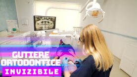 GUTIERE ORTODONTICE INVIZIBILE