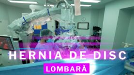 HERNIA DE DISC LOMBARĂ