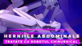 HERNIILE ABDOMINALE TRATATE CU ROBOTUL CHIRURGICAL