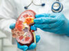 Kidney disease, Chronic kidney disease ckd, Doctor with human mo