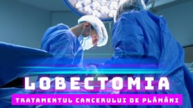 LOBECTOMIA, TRATAMENTUL CANCERULUI DE PLAMANI