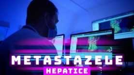 METASTAZELE HEPATICE
