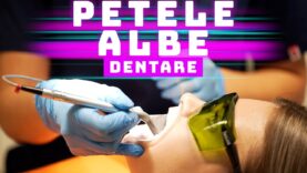 PETELE ALBE DENTARE