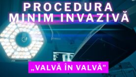 PROCEDURA MINIM INVAZIVĂ „VALVĂ ÎN VALVĂ”