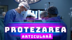PROTEZAREA ARTICULARĂ