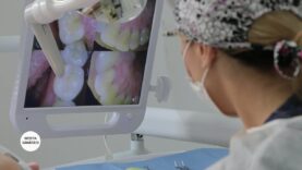 RECONSTRUCȚIA DINȚILOR AFECTAȚI