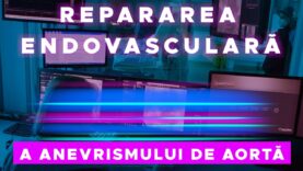 REPARAREA ENDOVASCULARĂ A ANEVRISMULUI DE AORTĂ