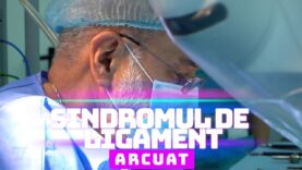 SINDROMUL DE LIGAMENT ARCUAT