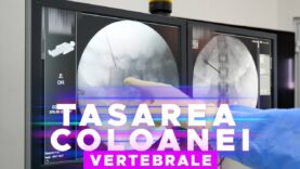 TASAREA VERTEBRALĂ