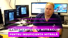 TRATAMENTUL CU MITRACLIP PENTRU INSUFICIENȚA MITRALĂ