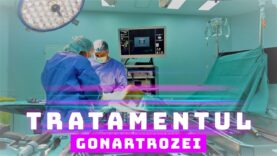 TRATAMENTUL GONARTROZEI