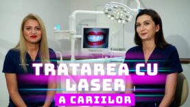 TRATAREA CU LASER A CARIILOR