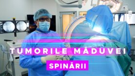TUMORILE MĂDUVEI SPINĂRII