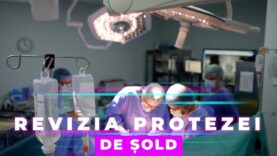 REVIZIA PROTEZEI DE ȘOLD