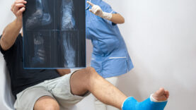 X-ray of a foot fracture close-up on a consultation with a doctor.