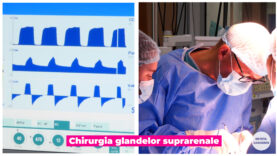Chirurgia glandelor suprarenale.00_00_31_10.Still003