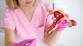 A gynecologist using a model of a female uterus shows students the process of taking gynecological swabs