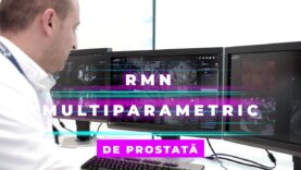 RMN DE PROSTATĂ