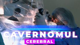 CAVERNOMUL CEREBRAL
