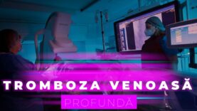 TROMBOZA VENOASĂ PROFUNDĂ