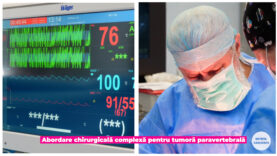 TUMORA PARAVERTEBRALA.00_00_41_19.Still003