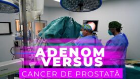 ADENOM VERSUS CANCER DE PROSTATĂ