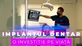 IMPLANTUL DENTAR, O INVESTIȚIE PE VIAȚĂ