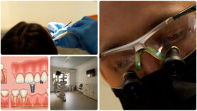 IMPLANTURI – 5.00_01_25_08.Still005