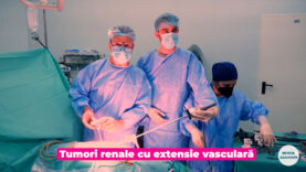 TUMORI RENALE CU EXTENSIE VASCULARA.00_00_11_23.Still002