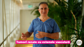 TUMORI RENALE CU EXTENSIE VASCULARA.00_02_15_19.Still004