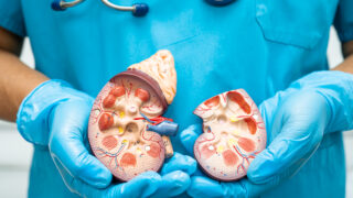 Kidney disease, Chronic kidney disease ckd, Doctor hold human mo